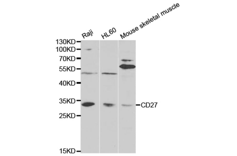 Anti-CD27 Antibody from Bioworld Technology (BS6549) - Antibodies.com