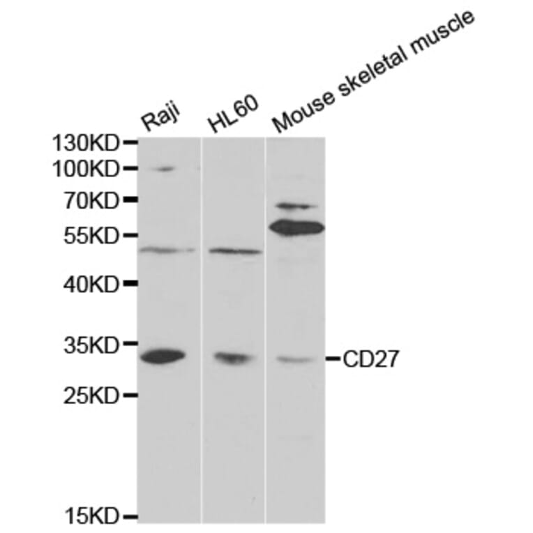 Anti-CD27 Antibody from Bioworld Technology (BS6549) - Antibodies.com