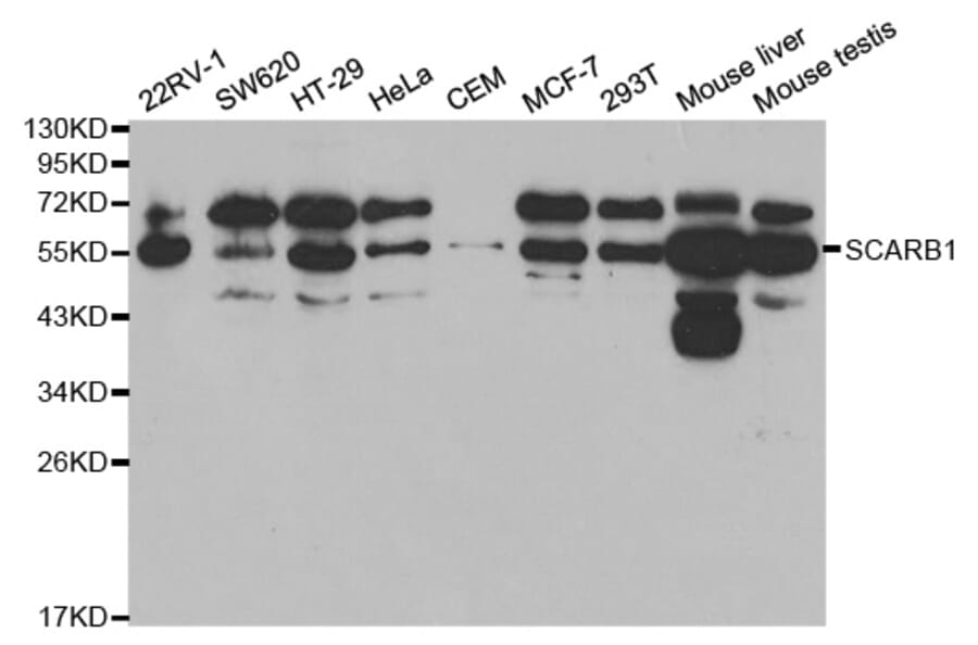 Anti-SCARB1 Antibody from Bioworld Technology (BS6551) - Antibodies.com