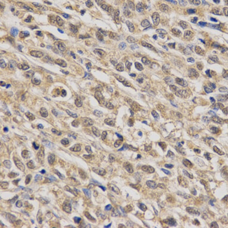 Anti-SCARB1 Antibody from Bioworld Technology (BS6551) - Antibodies.com