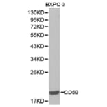 Anti-CD59 Antibody from Bioworld Technology (BS6553) - Antibodies.com
