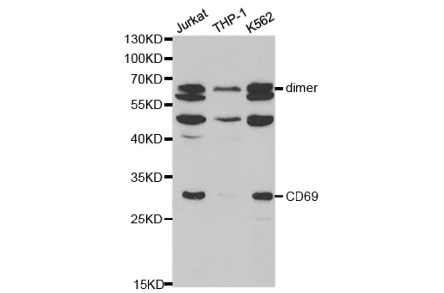 Anti-CD69 Antibody from Bioworld Technology (BS6554) - Antibodies.com
