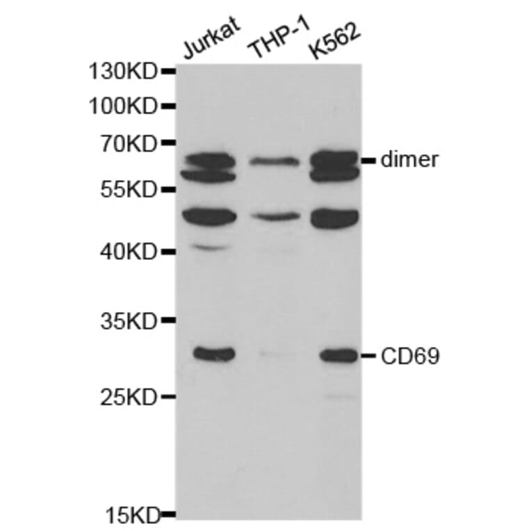 Anti-CD69 Antibody from Bioworld Technology (BS6554) - Antibodies.com