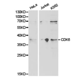 Anti-CDK6 Antibody from Bioworld Technology (BS6559) - Antibodies.com