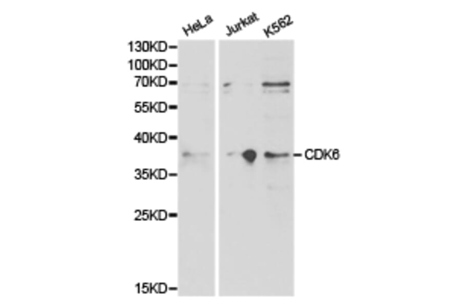 Anti-CDK6 Antibody from Bioworld Technology (BS6559) - Antibodies.com