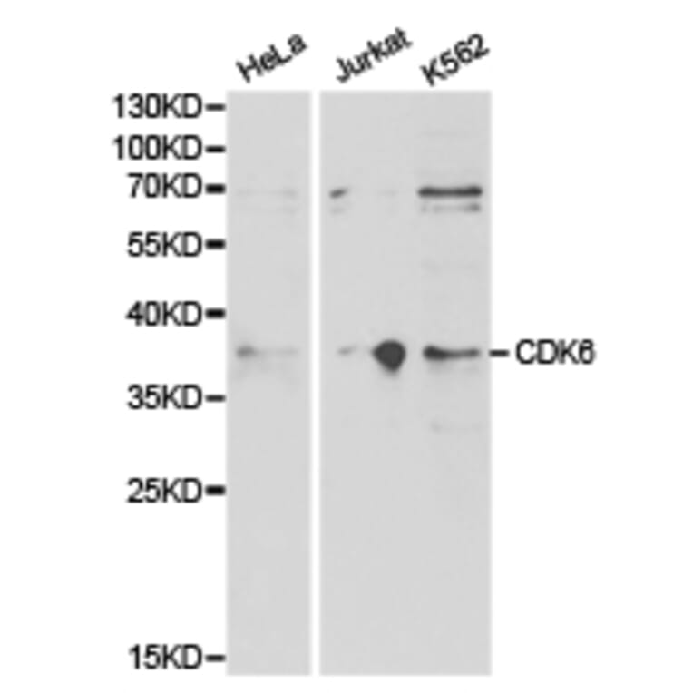 Anti-CDK6 Antibody from Bioworld Technology (BS6559) - Antibodies.com