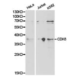 Anti-CDK6 Antibody from Bioworld Technology (BS6559) - Antibodies.com