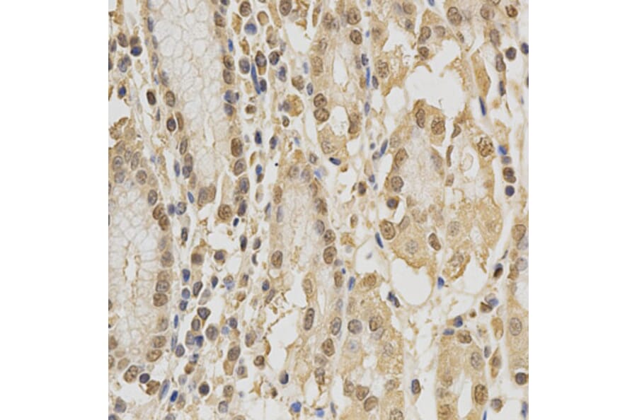 Anti-CDK6 Antibody from Bioworld Technology (BS6559) - Antibodies.com