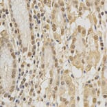 Anti-CDK6 Antibody from Bioworld Technology (BS6559) - Antibodies.com