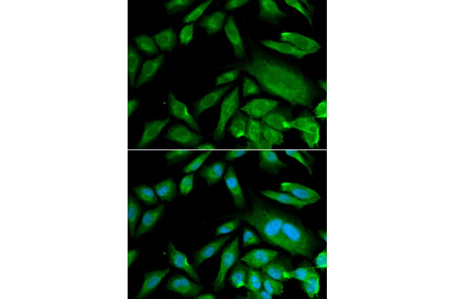Anti-CDK6 Antibody from Bioworld Technology (BS6559) - Antibodies.com