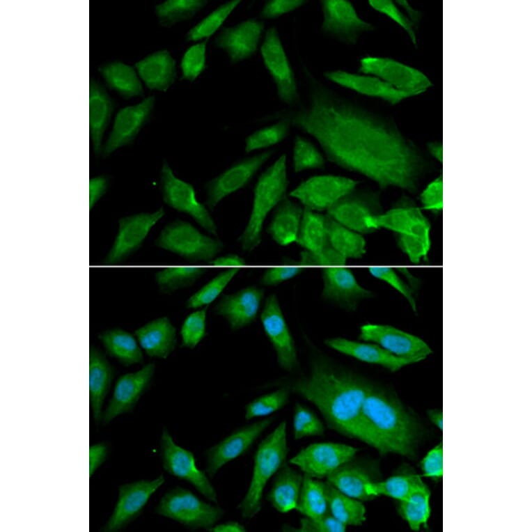 Anti-CDK6 Antibody from Bioworld Technology (BS6559) - Antibodies.com