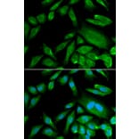 Anti-CDK6 Antibody from Bioworld Technology (BS6559) - Antibodies.com