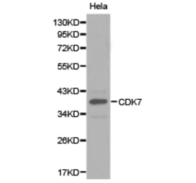 Anti-CDK7 Antibody from Bioworld Technology (BS6560) - Antibodies.com