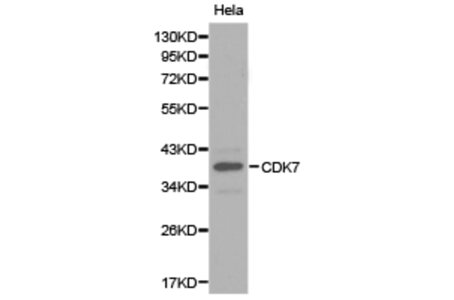 Anti-CDK7 Antibody from Bioworld Technology (BS6560) - Antibodies.com