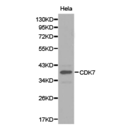 Anti-CDK7 Antibody from Bioworld Technology (BS6560) - Antibodies.com