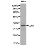 Anti-CDK7 Antibody from Bioworld Technology (BS6560) - Antibodies.com