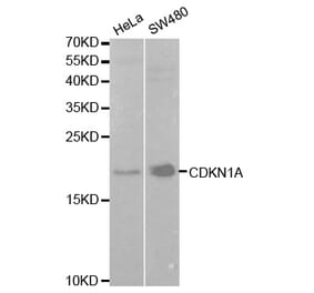 Anti-p21 (FL) Antibody from Bioworld Technology (BS6561) - Antibodies.com