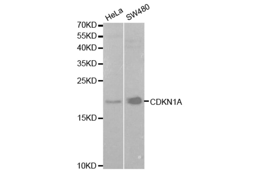 Anti-p21 (FL) Antibody from Bioworld Technology (BS6561) - Antibodies.com