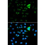 Anti-p21 (FL) Antibody from Bioworld Technology (BS6561) - Antibodies.com