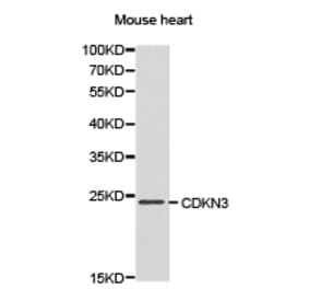 Anti-CDKN3 Antibody from Bioworld Technology (BS6562) - Antibodies.com