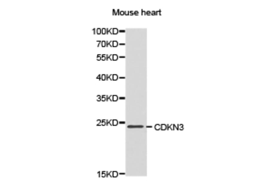 Anti-CDKN3 Antibody from Bioworld Technology (BS6562) - Antibodies.com