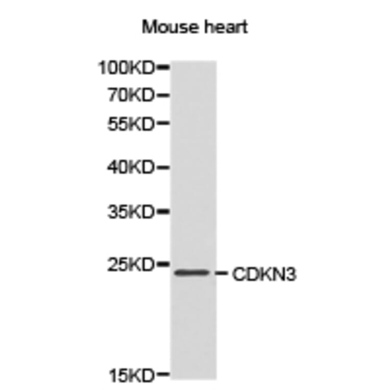 Anti-CDKN3 Antibody from Bioworld Technology (BS6562) - Antibodies.com