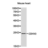 Anti-CDKN3 Antibody from Bioworld Technology (BS6562) - Antibodies.com