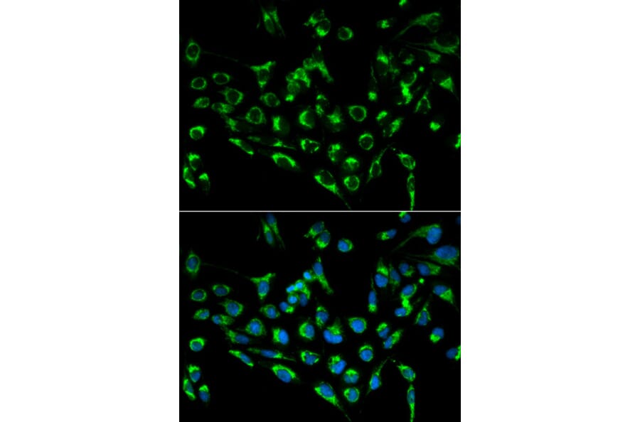 Anti-CDKN3 Antibody from Bioworld Technology (BS6562) - Antibodies.com