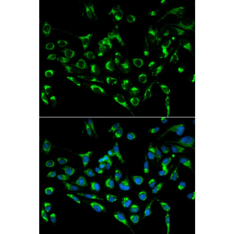 Anti-CDKN3 Antibody from Bioworld Technology (BS6562) - Antibodies.com