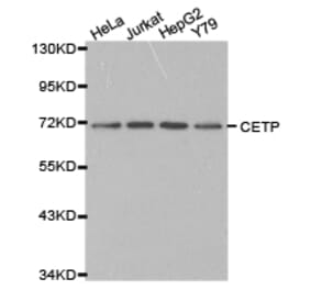 Anti-CETP Antibody from Bioworld Technology (BS6563) - Antibodies.com