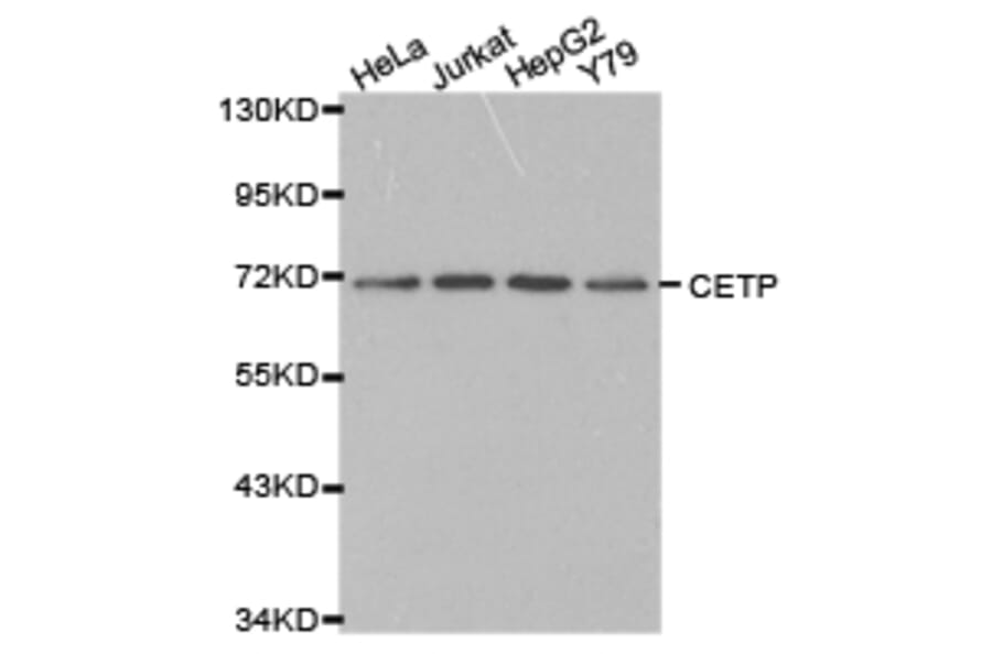 Anti-CETP Antibody from Bioworld Technology (BS6563) - Antibodies.com