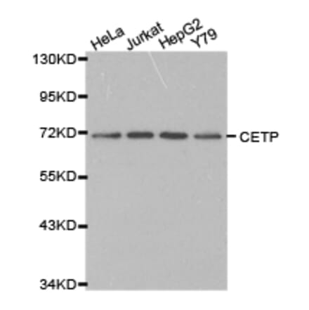 Anti-CETP Antibody from Bioworld Technology (BS6563) - Antibodies.com