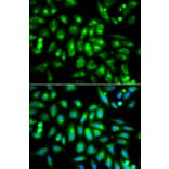 Anti-mAChR M2 Antibody from Bioworld Technology (BS6566) - Antibodies.com