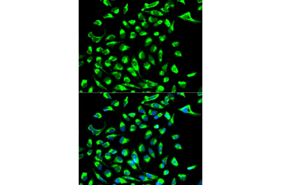 Anti-Claudin 7 Antibody from Bioworld Technology (BS6569) - Antibodies.com