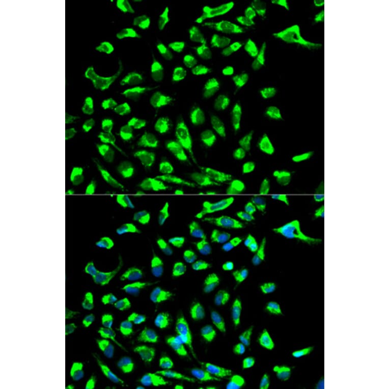 Anti-Claudin 7 Antibody from Bioworld Technology (BS6569) - Antibodies.com