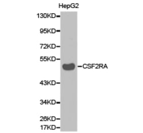 Anti-CSF2RA Antibody from Bioworld Technology (BS6570) - Antibodies.com