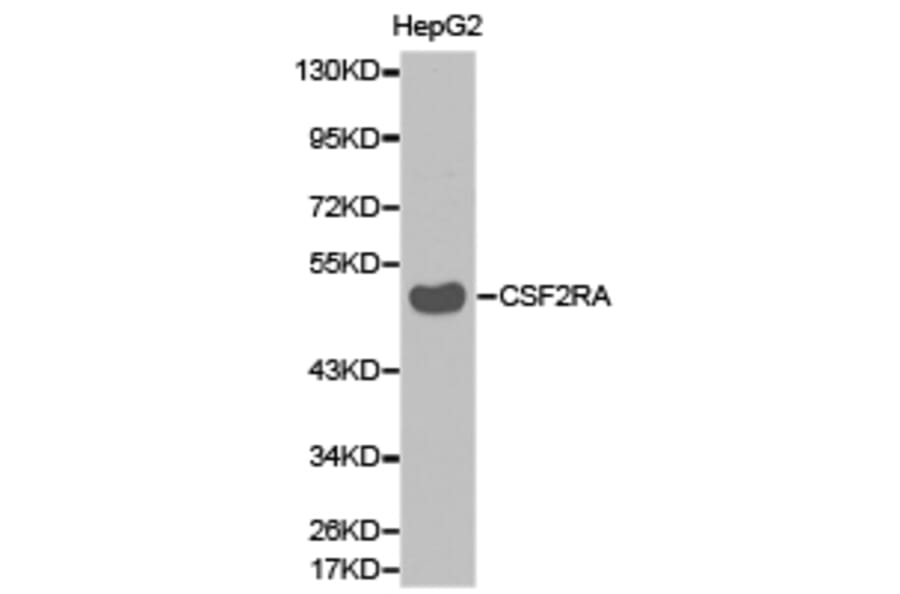 Anti-CSF2RA Antibody from Bioworld Technology (BS6570) - Antibodies.com