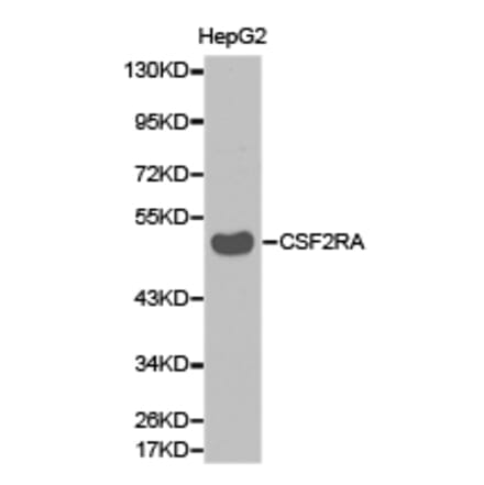Anti-CSF2RA Antibody from Bioworld Technology (BS6570) - Antibodies.com