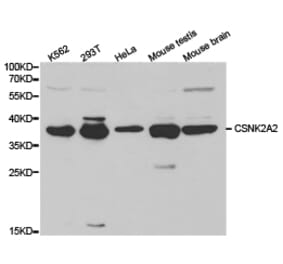 Anti-CSNK2A2 Antibody from Bioworld Technology (BS6571) - Antibodies.com