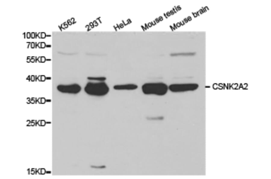 Anti-CSNK2A2 Antibody from Bioworld Technology (BS6571) - Antibodies.com