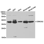Anti-CSNK2A2 Antibody from Bioworld Technology (BS6571) - Antibodies.com