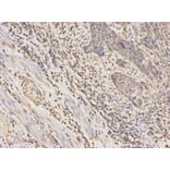 Anti-CSNK2A2 Antibody from Bioworld Technology (BS6571) - Antibodies.com