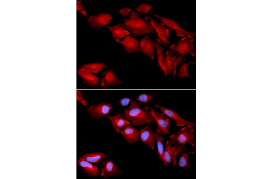 Anti-Catenin-δ1 Antibody from Bioworld Technology (BS6572) - Antibodies.com