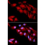 Anti-Catenin-δ1 Antibody from Bioworld Technology (BS6572) - Antibodies.com