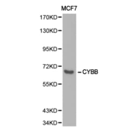 Anti-gp91-phox/CYBB Antibody from Bioworld Technology (BS6574) - Antibodies.com
