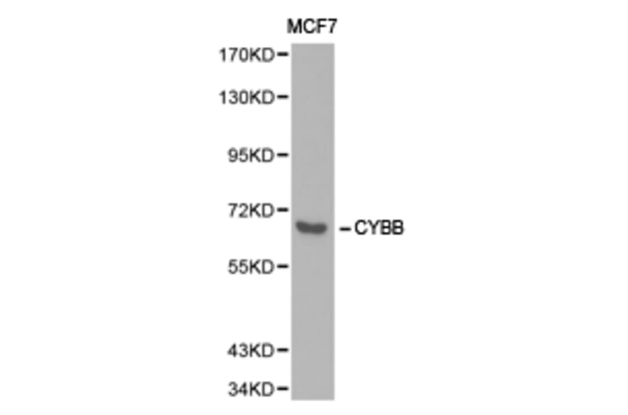 Anti-gp91-phox/CYBB Antibody from Bioworld Technology (BS6574) - Antibodies.com