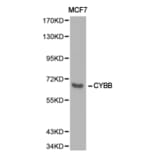 Anti-gp91-phox/CYBB Antibody from Bioworld Technology (BS6574) - Antibodies.com