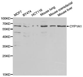 Anti-CYP1A1 Antibody from Bioworld Technology (BS6575) - Antibodies.com