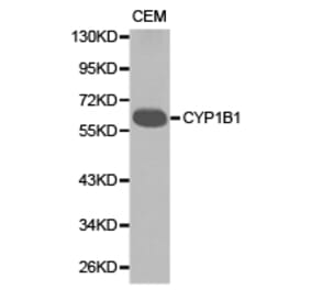 Anti-CYP1B1 Antibody from Bioworld Technology (BS6576) - Antibodies.com