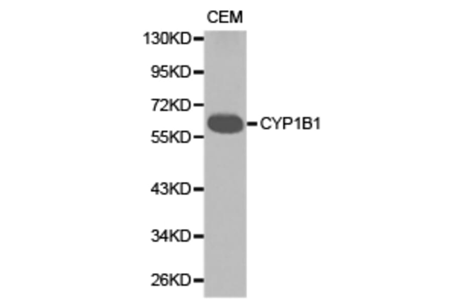 Anti-CYP1B1 Antibody from Bioworld Technology (BS6576) - Antibodies.com